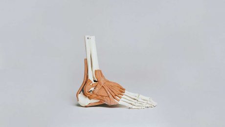 Orthopädie Fuß