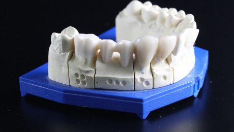 Zahnersatz-3D-Druck-Symbolbild